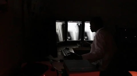 Doctor examining x-ray Stock Footage 32906018