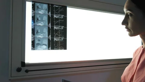 Doctor examining an X-ray Stock-Footage 95484423