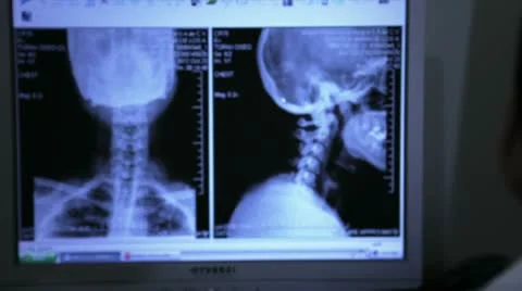 Doctor examining X ray result and neuroimaging Stock Footage