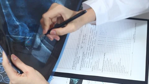 Doctor examining with X-rays of bones in the office Stock Footage 86690210