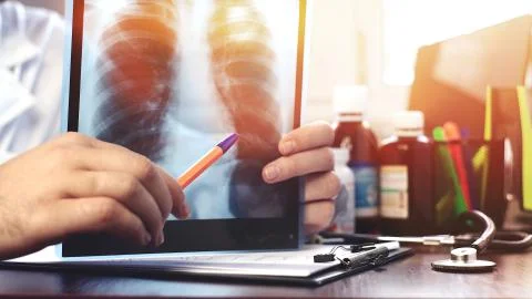 Doctor explaining x-ray image of a chest to a patient. Concept: 2019-ncov, covid Stock Photos