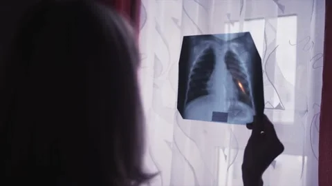 Doctor, gloves, medicine, x-ray, medical equipment Stock Footage 131741253