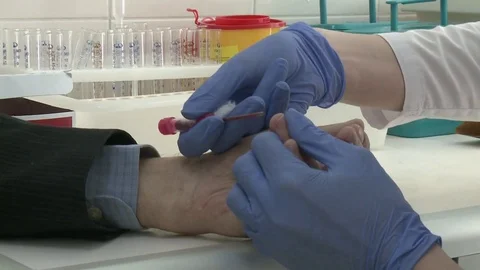 Doctor hand taking blood sample for medical test Stock Footage 76616438