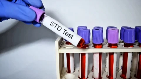 Doctor hold Blood sample for STD (Sexually Transmitted Disease) Test. Stock Footage 307334423