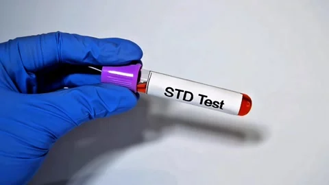 Doctor hold Blood sample for STD (Sexually Transmitted Disease) Test. Stock Footage 307334426