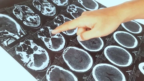 Doctor holding CT scan array with human head on top. Concept of X-ray medicine Stock Footage 306226868