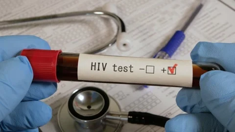 Doctor holding hiv negative test tube Stock Footage 310518866