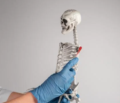 Doctor holding skeleton arm with red shoulder. Painful joints. Overuse, tendo Stock Photos