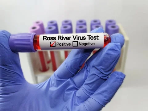 Doctor holding a test blood sample tube with Ross River Virus test Stock Footage 296902835