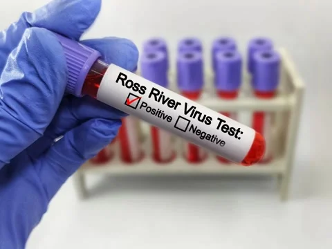 Doctor holding a test blood sample tube with Ross River Virus test Stock Footage 296902859