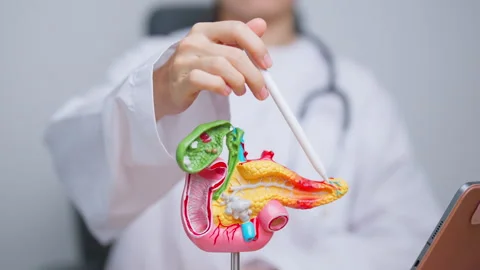 Doctor with human Pancreatitis anatomy m... | Stock Video | Pond5