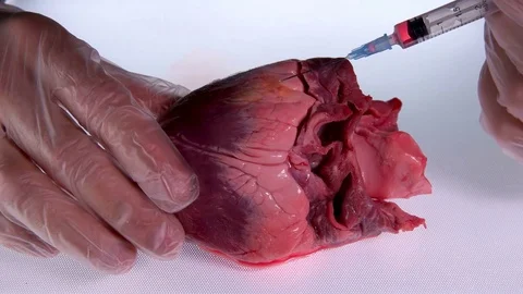 The doctor injects in the heart of the solution of the medication in the syringe Stock Footage 79905660