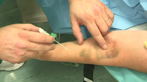 Doctor inserting needle in patient's arm Stock Footage 45899874