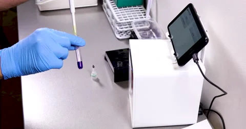 Doctor inserts a test tube into the analyzer Stock Footage 172401489