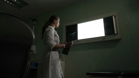 The doctor inserts an X-ray in the X-ray viewer Video stock 96513757