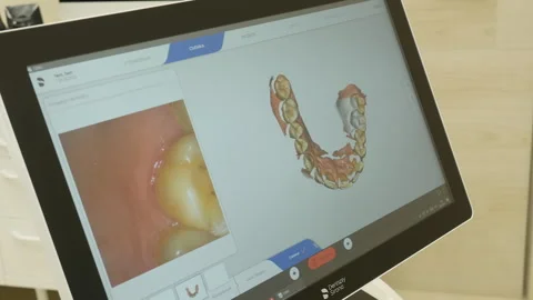 Doctor inspects at  3d model of x-rays of the patient's jaw and teeth  Stock Footage 245487942