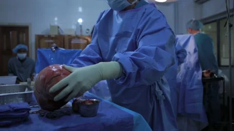 Doctor keeping tumor on the table Stock Footage 62389025