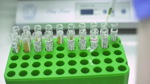 Doctor in the lab doing the sampling of biological material for analysis Stock Footage 140964276