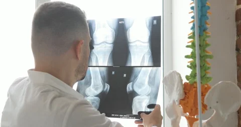 Doctor is learning bones on x-ray images sitting near the window, back view. Stock Footage 108021055