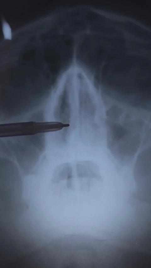 Doctor learning Vertical X-ray scan of a human skull 스톡 동영상 295666549