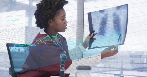 Doctor lifting chest X-ray, tilting film, pointing lungs, explaining findings Stock Footage 331024900