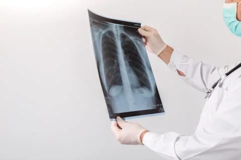 Doctor looking at chest x-ray Stock Photos