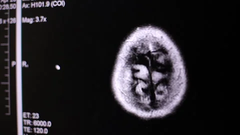 Doctor looking at computer screen while patient moving in mri machine, the Stock Footage 89264825