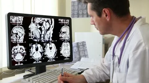 Doctor looking at CT scan Stock Footage 12614178