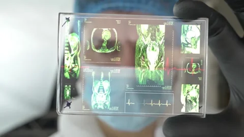 Doctor looking at EKG Stockbeeldmateriaal 146661141