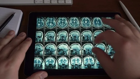 Doctor looking at tablet on his table with MRI brain scan or x-ray Stock Footage 89362624