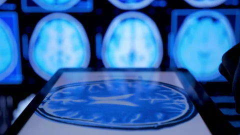 Doctor looking on tablet x-ray  Stock Footage 194881832