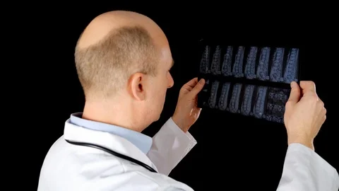 Doctor looking x-ray of backbones isolated on black background. Surgeon in Stock Footage 126394925