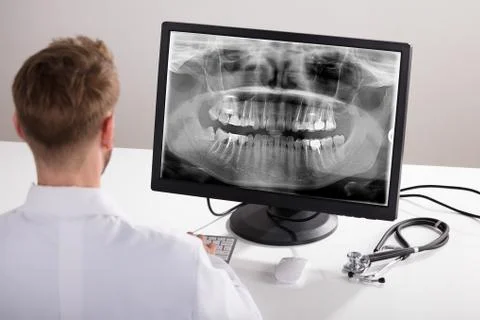 Doctor Looking At X-ray On Computer Stock Photos