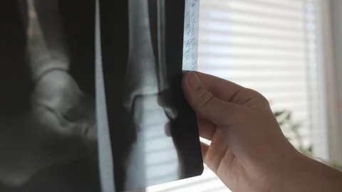 Doctor is looking at X-ray Stock Footage 115256139