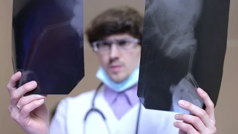 Doctor looking x-ray of the human body Stock Footage 73763671