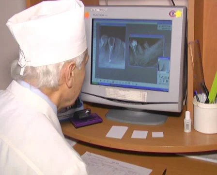 Doctor looking x-ray image 2 Stock Footage 35015177