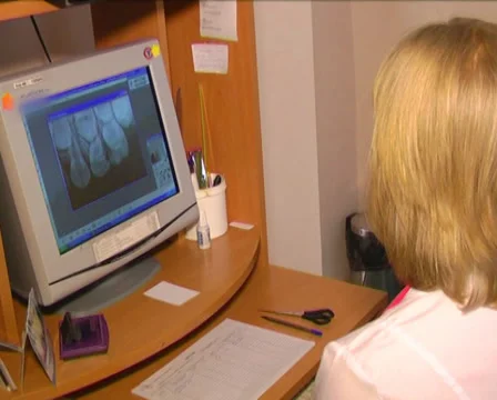 Doctor looking x-ray image 1 Stock Footage 35015228