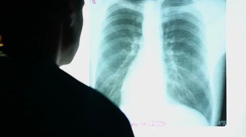 Doctor looking at X-ray image of human chest, scanning lungs Stock Footage 40706527