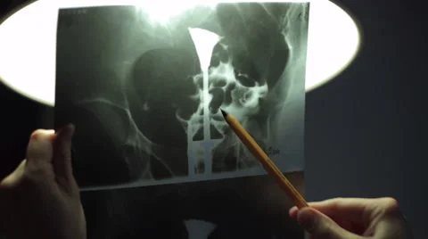 Doctor looking at x-ray image Stock Footage 47091813