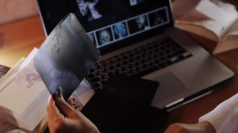 Doctor looking at an x-ray, medical records laptop Vídeo Stock 59195650