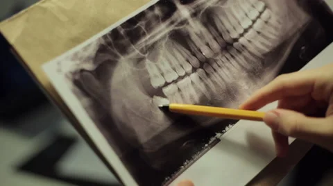 Doctor looking at x-ray of teeth Stock Footage 47091876