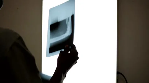Doctor looking at X-rays in front of an illuminated panel Stock Footage 49009692