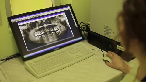 The doctor looks at a snapshot of teeth Stock-Footage 71619702