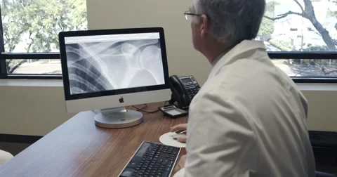 Doctor looks at x-rays on computer 스톡 동영상 46250216