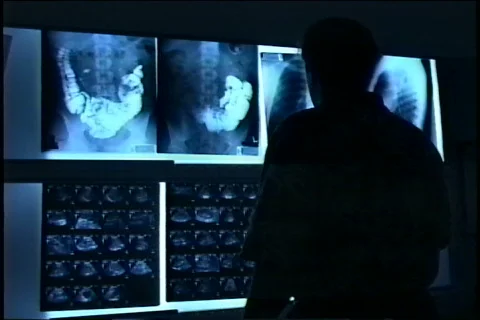 Doctor looks at  X-rays Video stock 343535