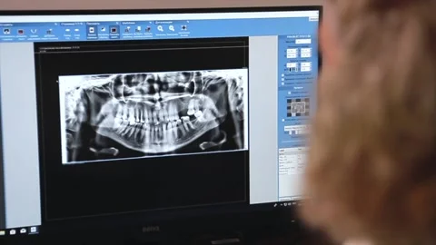 The doctor looks at x-rays of teeth on the screen Video stock 168569420