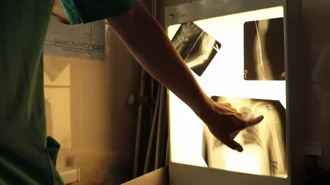 The doctor makes a diagnosis using an x-ray. Stock Footage 198805814