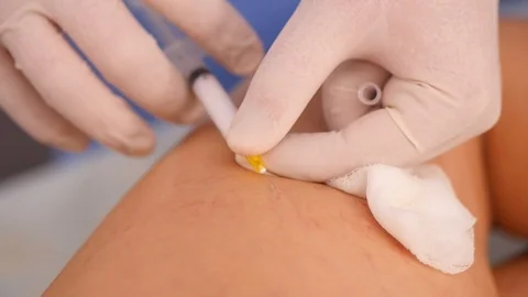 The doctor makes an injection Stock Footage 85590249