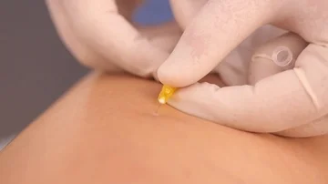 Doctor makes an injection in the leg Video stock 85590244