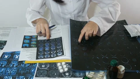 The doctor makes notes about brain diseases Stock-Footage 87477647